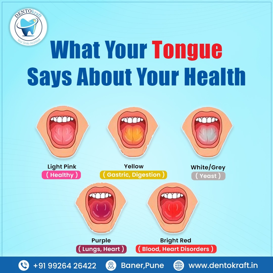 What Your Tongue Says About Your Health